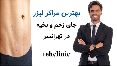 بهترین مراکز لیزر جای زخم و بخیه در تهرانسر