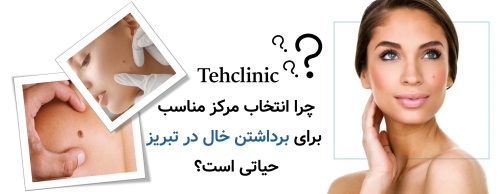 چرا انتخاب مرکز مناسب برای برداشتن خال در تبریز حیاتی است؟