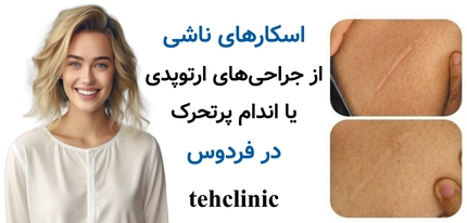 اسکارهای ناشی از جراحیهای ارتوپدی یا اندام پرتحرک در فردوس