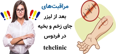 مراقبتهای بعد از لیزر جای زخم و بخیه در فردوس
