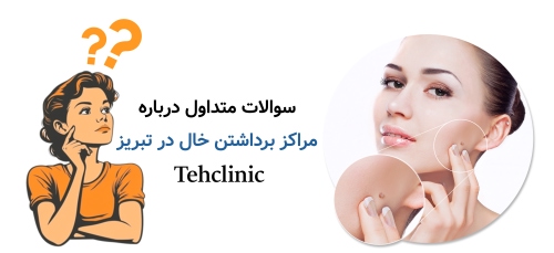 سوالات متداول درباره مراکز برداشتن خال در تبریز