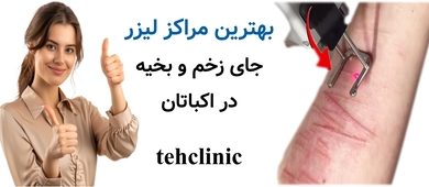 بهترین مراکز لیزر جای زخم و بخیه در اکباتان