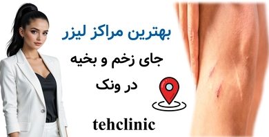 بهترین مراکز لیزر جای زخم و بخیه در ونک
