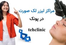 مراکز لیزر لک صورت در پونک