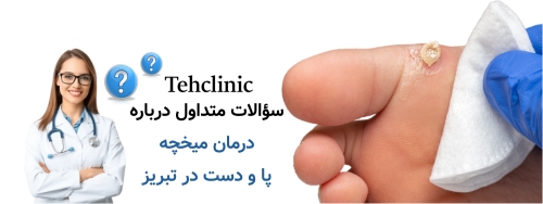سؤالات متداول درباره درمان میخچه پا و دست در تبریز