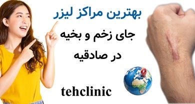 بهترین مراکز لیزر جای زخم و بخیه در صادقیه