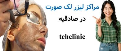 مراکز لیزر لک صورت در صادقیه