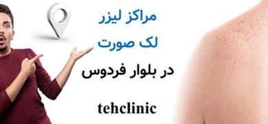 مراکز لیزر لک صورت در بلوار فردوس