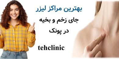 بهترین مراکز لیزر جای زخم و بخیه در پونک
