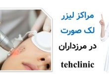 مراکز لیزر لک صورت در مرزداران