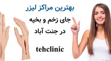 بهترین مراکز لیزر جای زخم و بخیه در جنت آباد