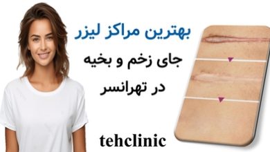 بهترین مراکز لیزر جای زخم و بخیه در تهرانسر