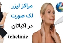 مراکز لیزر لک صورت در اکباتان