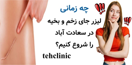 چه زمانی لیزر جای زخم و بخیه در سعادت آباد را شروع کنیم؟