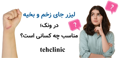 لیزر جای زخم و بخیه در ونک؛ مناسب چه کسانی است؟