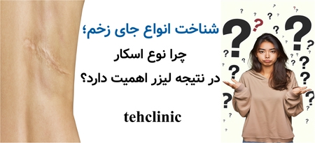 شناخت انواع جای زخم؛ چرا نوع اسکار در نتیجه لیزر اهمیت دارد؟