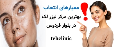 معیارهای انتخاب بهترین مرکز لیزر لک در بلوار فردوس