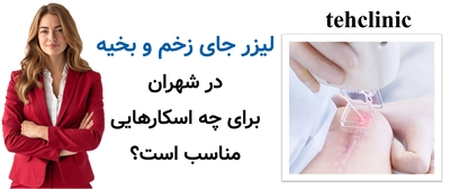 لیزر جای زخم و بخیه در شهران برای چه اسکارهایی مناسب است؟