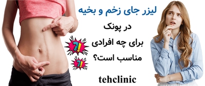 لیزر جای زخم و بخیه در پونک برای چه افرادی مناسب است؟