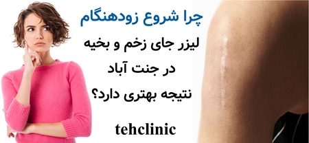 چرا شروع زودهنگام لیزر جای زخم و بخیه در جنت آباد نتیجه بهتری دارد؟
