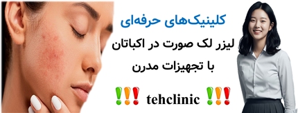 کلینیک‌های حرفه‌ای لیزر لک صورت در اکباتان با تجهیزات مدرن
