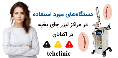 دستگاه‌های مورد استفاده در مراکز لیزر جای بخیه در اکباتان