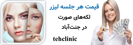 قیمت هر جلسه لیزر لکه‌های صورت در جنت‌آباد