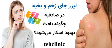 لیزر جای زخم و بخیه در صادقیه چگونه باعث بهبود اسکار می‌شود؟