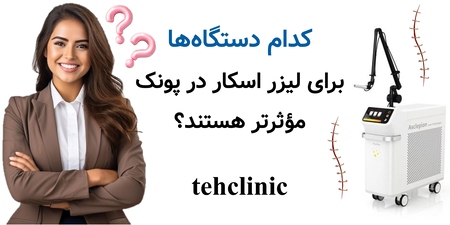 کدام دستگاه‌ها برای لیزر اسکار در پونک مؤثرتر هستند؟