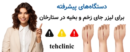 دستگاه‌های پیشرفته برای لیزر جای زخم و بخیه در ستارخان