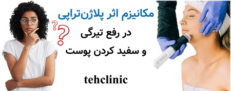 مکانیزم اثر پلاژن‌تراپی در رفع تیرگی و سفید کردن پوست