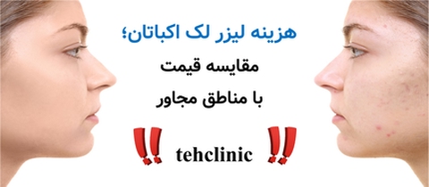 هزینه لیزر لک اکباتان؛ مقایسه قیمت با مناطق مجاور