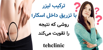 ترکیب لیزر با تزریق داخل اسکار؛ روشی که نتیجه را تقویت می‌کند