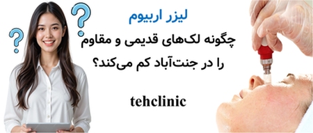 لیزر اربیوم چگونه لک‌های قدیمی و مقاوم را در جنت‌آباد کم می‌کند؟