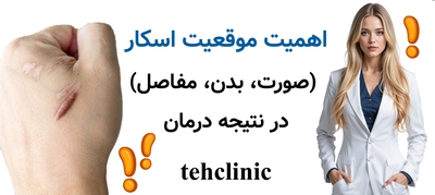 اهمیت موقعیت اسکار (صورت، بدن، مفاصل) در نتیجه درمان