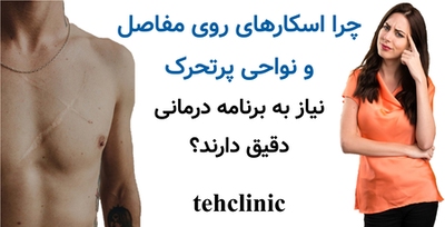 چرا اسکارهای روی مفاصل و نواحی پرتحرک نیاز به برنامه درمانی دقیق دارند؟