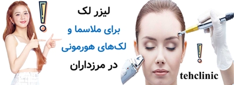 لیزر لک برای ملاسما و لک‌های هورمونی در مرزداران