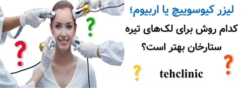 لیزر کیوسوییچ یا اربیوم؛ کدام روش برای لک‌های تیره ستارخان بهتر است؟