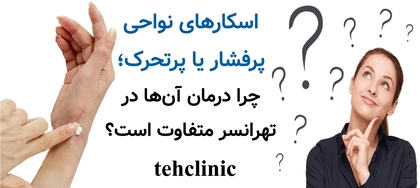 اسکارهای نواحی پرفشار یا پرتحرک؛ چرا درمان آنها در تهرانسر متفاوت است؟