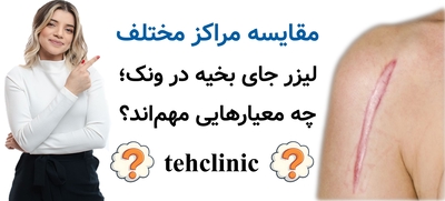 مقایسه مراکز مختلف لیزر جای بخیه در ونک؛ چه معیارهایی مهم‌اند؟