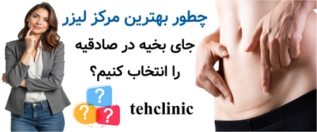 چطور بهترین مرکز لیزر جای بخیه در صادقیه را انتخاب کنیم؟