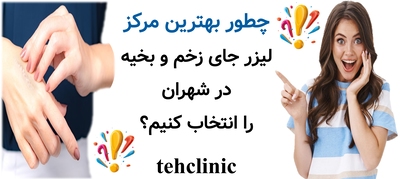 چطور بهترین مرکز لیزر جای زخم و بخیه در شهران را انتخاب کنیم؟