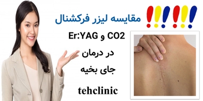 مقایسه لیزر فرکشنال CO2 و Er:YAG در درمان جای بخیه