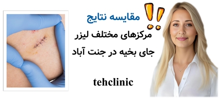 مقایسه نتایج مرکزهای مختلف لیزر جای بخیه در جنت آباد — چه سوالاتی بپرسید؟