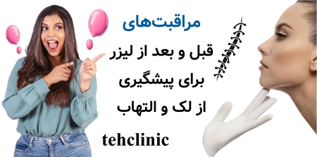 مراقبت‌های قبل و بعد از لیزر برای پیشگیری از لک و التهاب