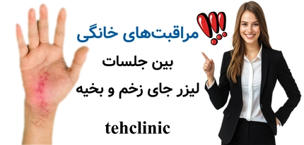 مراقبت‌های خانگی بین جلسات لیزر جای زخم و بخیه