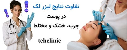 تفاوت نتایج لیزر لک در پوست چرب، خشک و مختلط