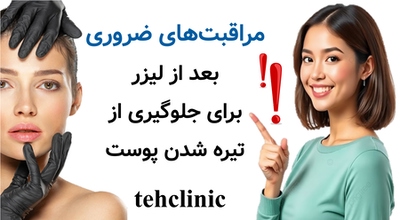 مراقبت‌های ضروری بعد از لیزر برای جلوگیری از تیره شدن پوست