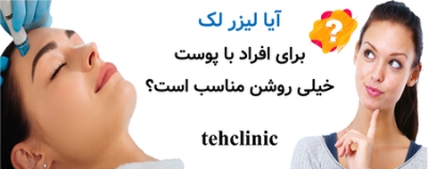 آیا لیزر لک برای افراد با پوست خیلی روشن مناسب است؟