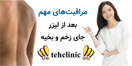 مراقبت‌های مهم بعد از لیزر جای زخم و بخیه